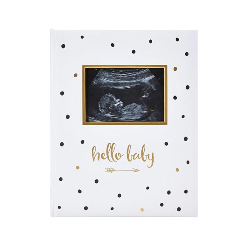 *Pearhead “Hello Baby” Sonogram Baby Book